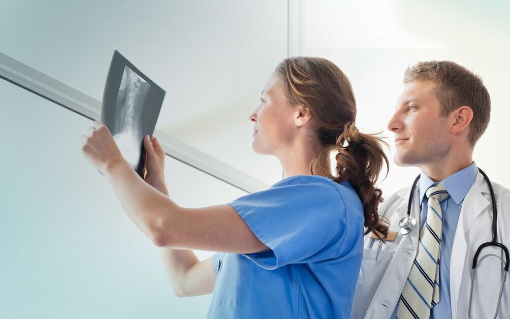 médecins regardant une radiographie pour l'arthrose